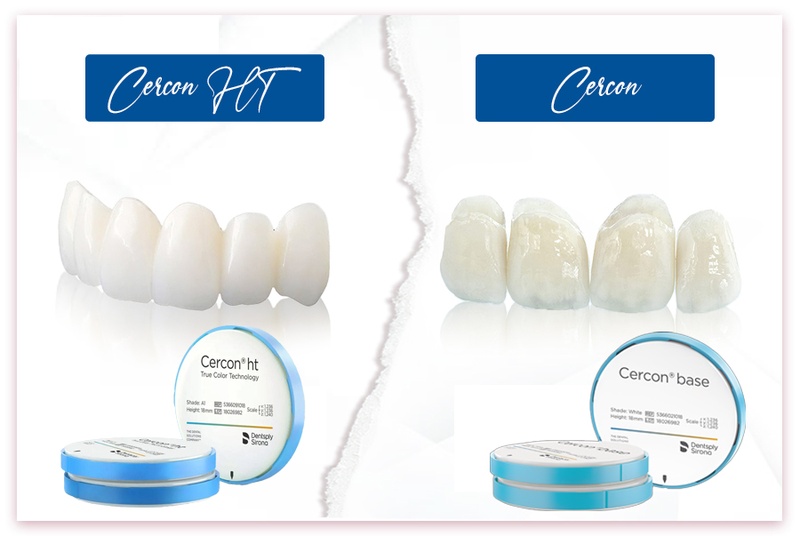 Thẩm mỹ và độ bền chắc của Cercon HT có phần nhỉnh hơn so với Cercon