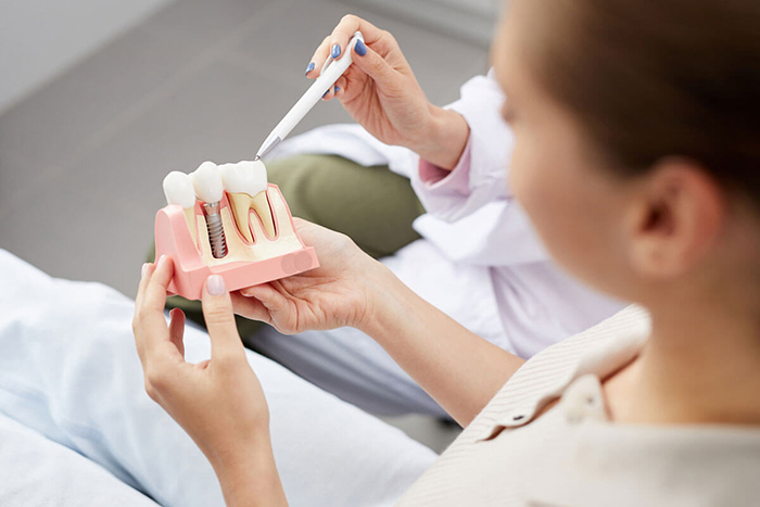 Trụ Implant Neodent có chi phí cao hơn so với các dòng trụ khác