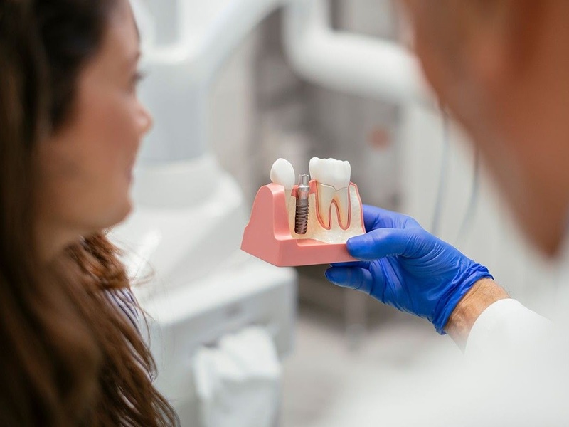 Tuân thủ lịch tái khám của bác sĩ sau cấy ghép Implant