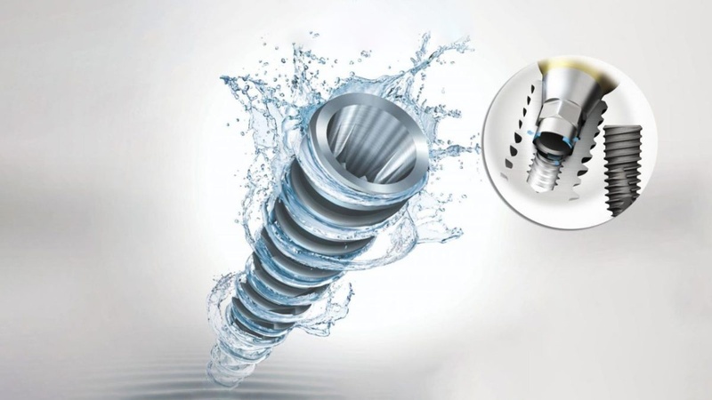 Vật liệu trụ lành tính tồn tại lâu dài trong môi trường miệng