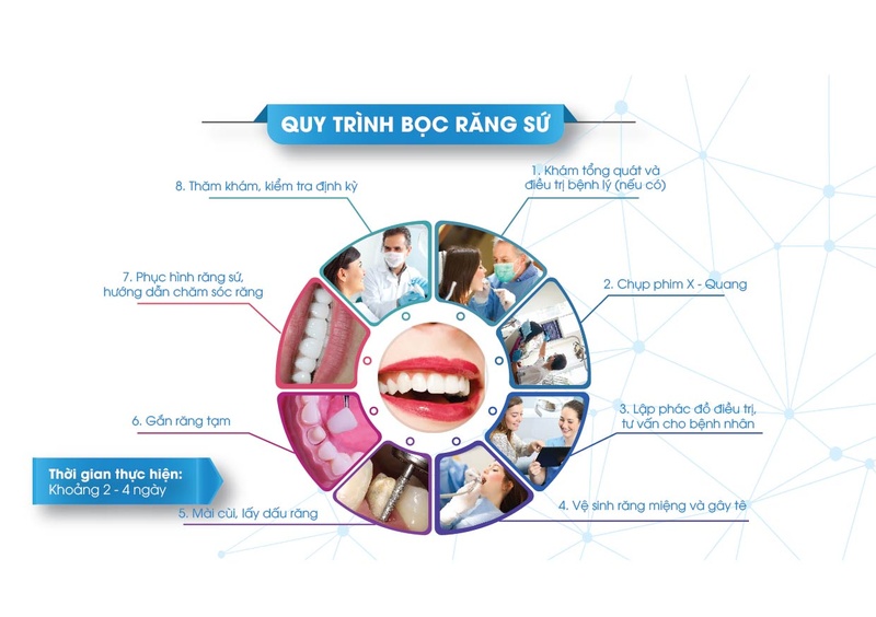 Quy trình bọc răng sứ tại Nha Khoa Đông Nam