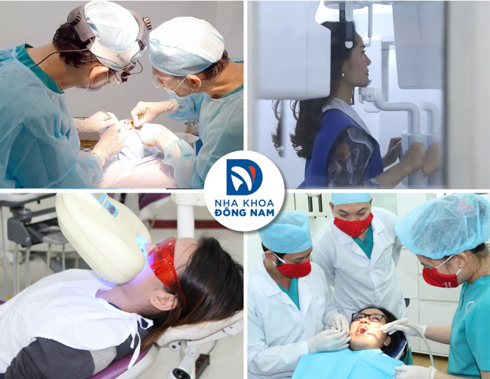 Quy trình tẩy trắng răng tại Nha khoa Đông Nam