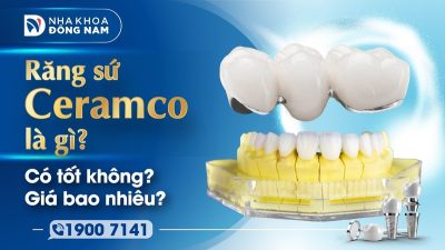 Răng sứ Ceramco là gì? Có tốt không? Giá bao nhiêu?