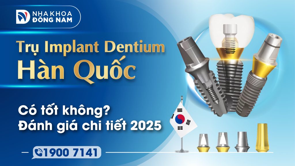 Trụ Implant Dentium Hàn Quốc có tốt không Đánh giá chi tiết 2025