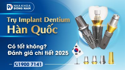 Trụ Implant Dentium Hàn Quốc có tốt không Đánh giá chi tiết 2025