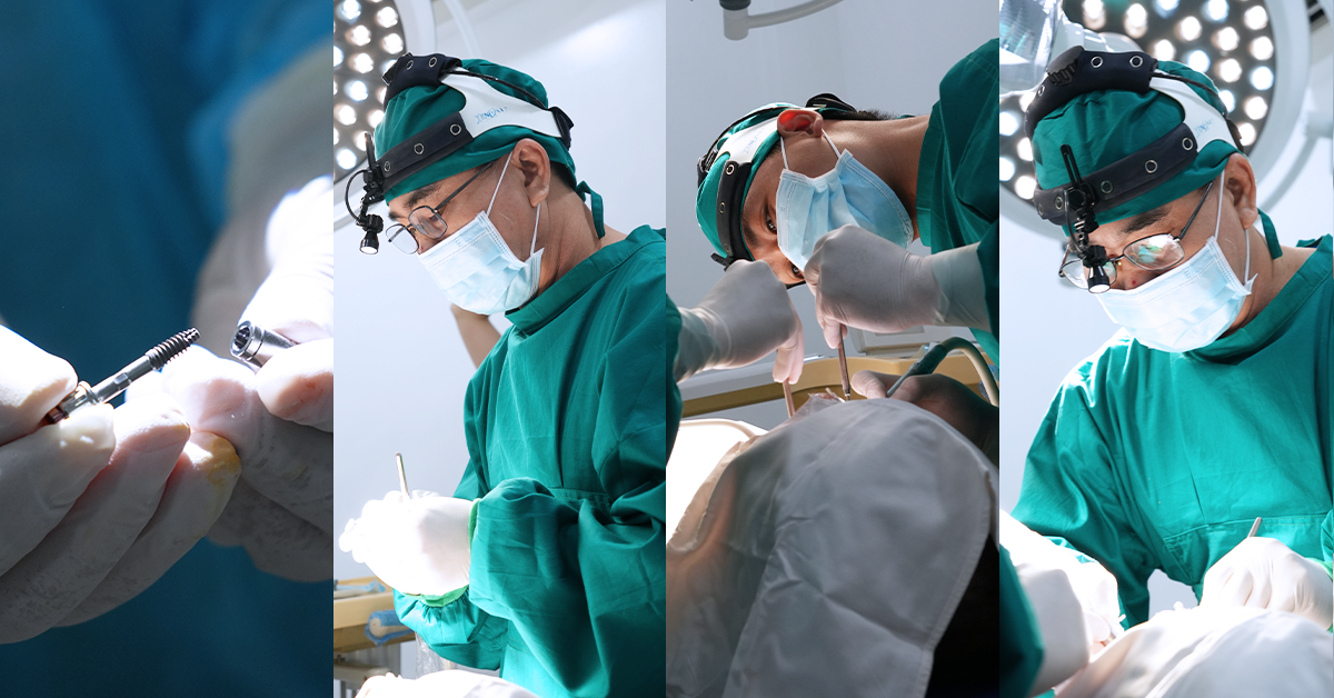 cấy Implant trong phòng vô trùng