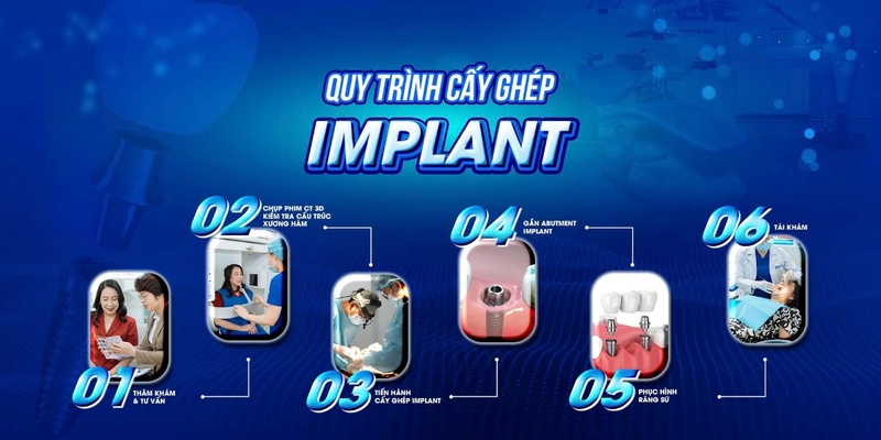 Quy trình cấy ghép Implant Thụy Sĩ tại Nha khoa Đông Nam