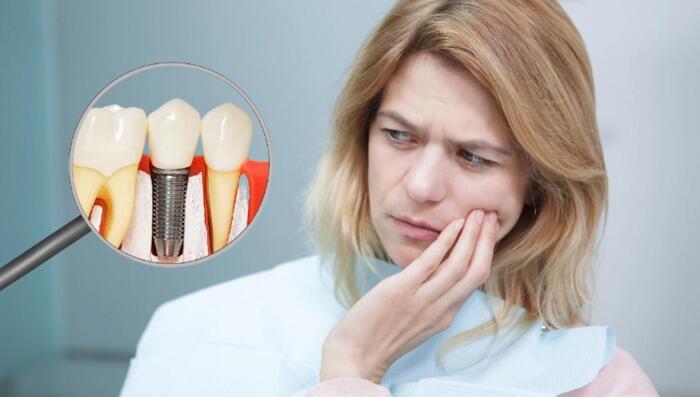 cắm implant bị nhức