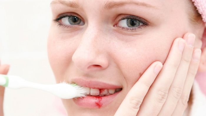 Chảy máu chân răng do cắm Implant bị lệch
