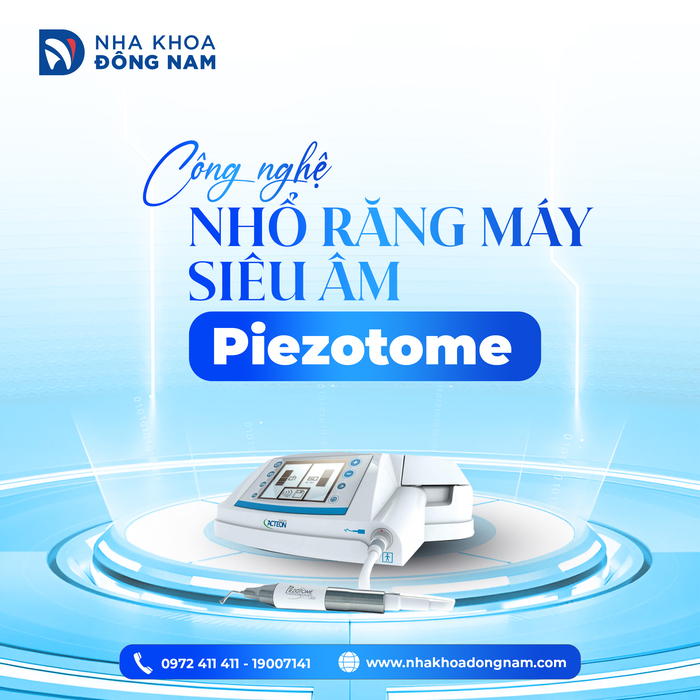 Công nghệ nhổ răng bằng máy siêu âm Piezotome giúp quá trình diễn ra nhẹ nhàng, nhanh chóng, hạn chế xâm lấn mô mềm, lành thương nhanh.