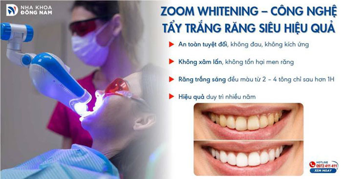 Công nghệ Zoom Whitening giúp loại bỏ mảng bám ố vàng trên răng hiệu quả, không đau, không ê buốt, không hại men răng.