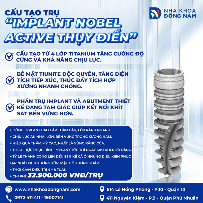 Implant Nobel Active Thụy Điển