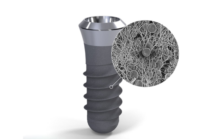 Các loại Implant Thụy Sĩ sở hữu nhiều ưu điểm về cấu tạo