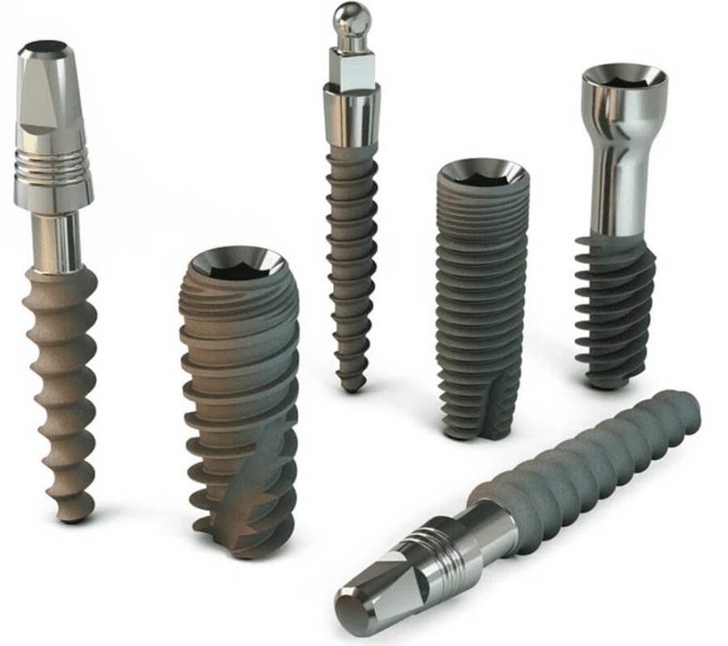 Lựa chọn các loại trụ Implant chất lượng