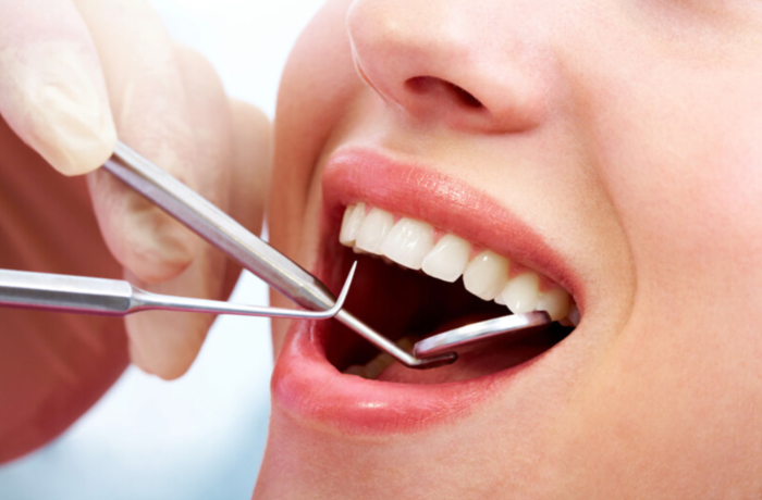 Nha Khoa Đông Nam - Địa chỉ nhổ răng an toàn
