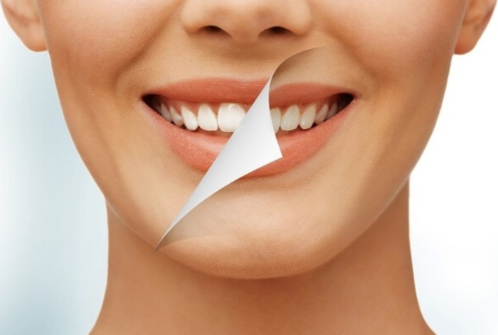 Chỉ nên tẩy trắng răng khi đã đủ 16 tuổi trở lên