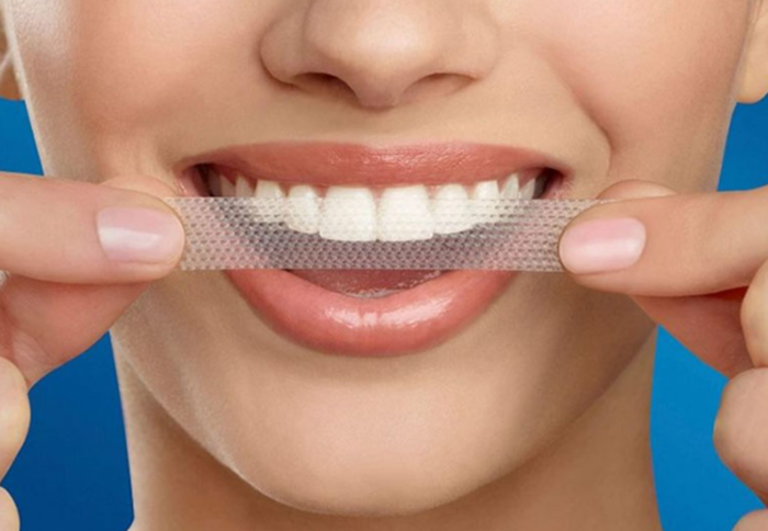 Tẩy trắng răng bằng miếng dán