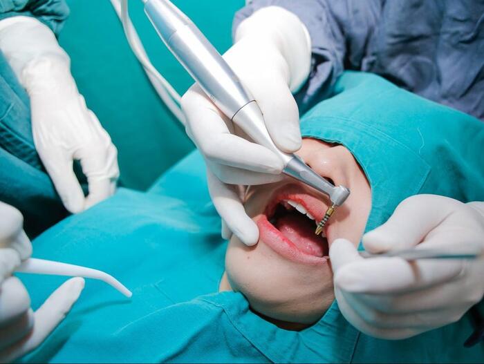 trồng răng implant có gây mê không