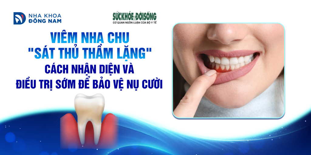 Cách nhận diện viêm nha chu