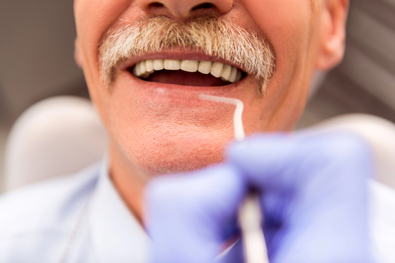 Lợi ích khi cấy ghép Implant toàn hàm