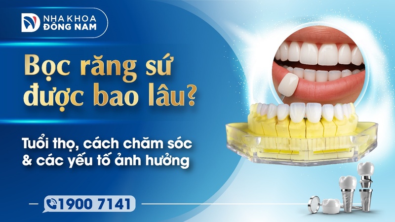 Bọc răng sứ được bao lâu? Tuổi thọ và cách chăm sóc để bền lâu