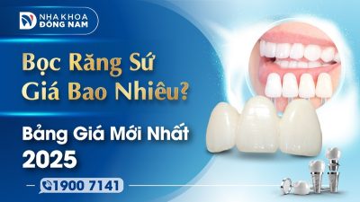 Bọc răng sứ giá bao nhiêu? Bảng giá mới nhất 2025