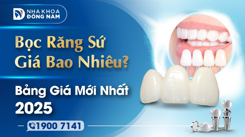 Bọc răng sứ giá bao nhiêu? Bảng giá mới nhất 2025