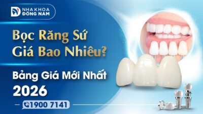 Bọc răng sứ giá bao nhiêu? Bảng giá mới nhất 2026
