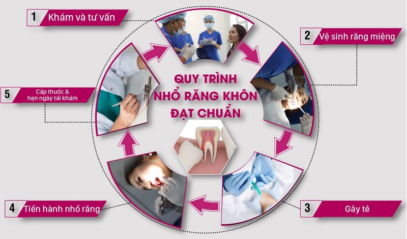 Quy trình nhổ răng khôn đúng chuẩn tại nha khoa