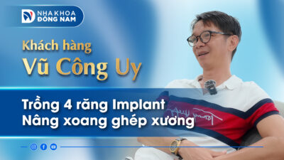 Review khách hàng Vũ Công Uy điều trị Implant