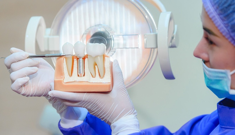 Trồng răng Implant mang lại nhiều lợi ích