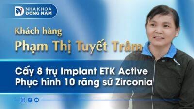 Câu chuyện khách hàng Phạm Thị Tuyết Trâm cấy 8 trụ Implant Pháp ETK Active