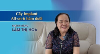 Câu chuyện khách hàng cấy ghép Implant All on 6