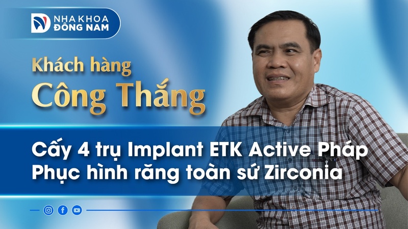 ANH TRƯƠNG CÔNG THẮNG CẤY 4 TRỤ IMPLANT HÀN QUỐC