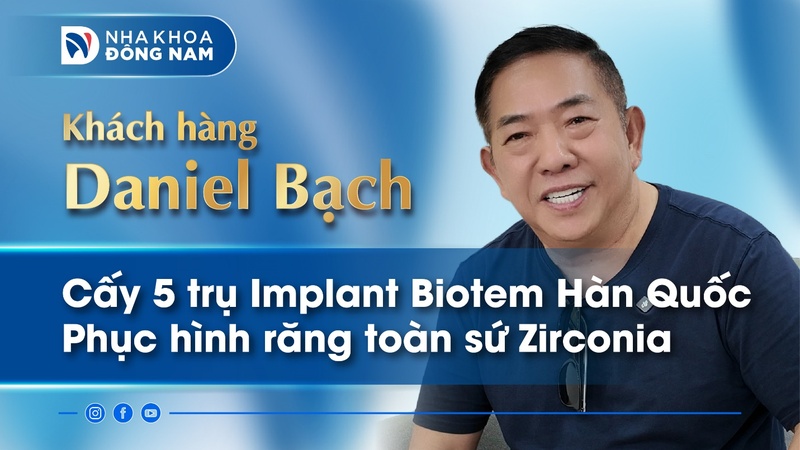 CHÚ DANIEL BẠCH CẤY 5 TRỤ IMPLANT VÀ PHỤC HÌNH RĂNG SỨ 2 HÀM