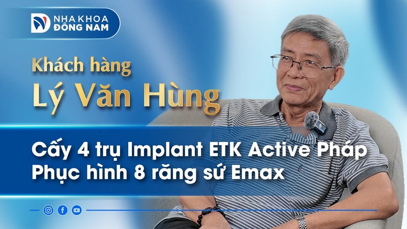 Review khách hàng Lý Văn Hùng cấy 4 trụ Implant ETK Active