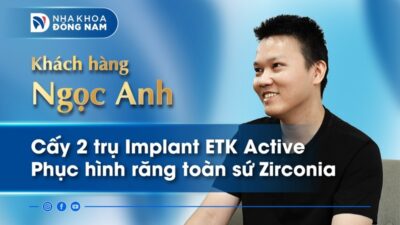 Review khách hàng Ngọc Anh cấy 2 trụ Implant ETK Active