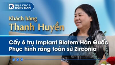 Review khách hàng Thanh Huyền cấy 6 trụ Implant Hàn Quốc