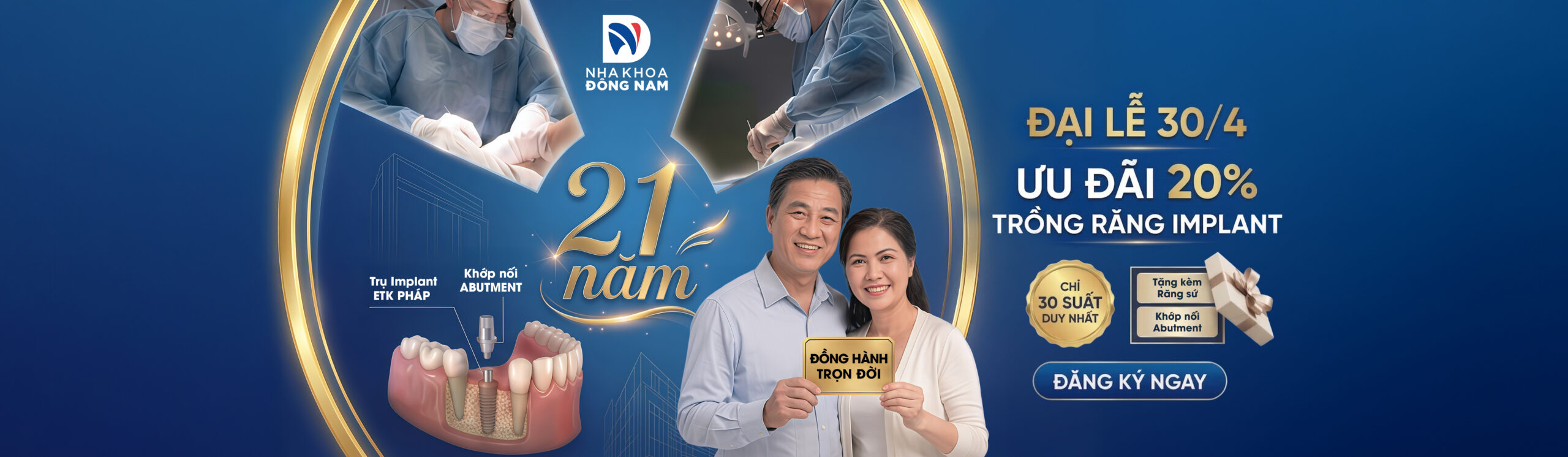 Banner Ưu Đãi 30/4 Implant - Nha Khoa Đông Nam